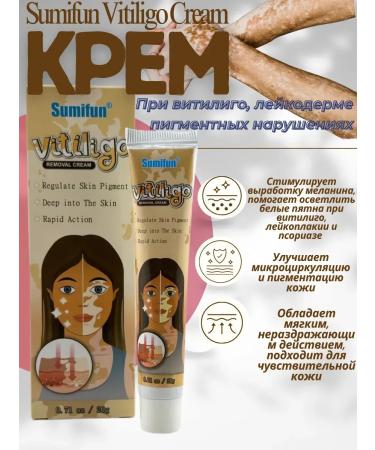 Ouch Chinese cream from vitiligo and pigmentation disorders