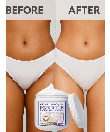 Dona7 Cream for elbows and knees from dark spots - Buy Online on GoSupps.com