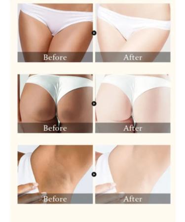Dona7 Cream for elbows and knees from dark spots - Buy Online on GoSupps.com