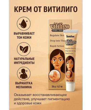 Strelicia Vitiligo cream for face and body skin