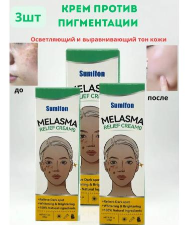 LABeauty Face cream against pigmentation