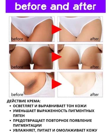 Vlar BEAUTY Cream for an intimate zone face and body bleaching - Buy Online on GoSupps.com