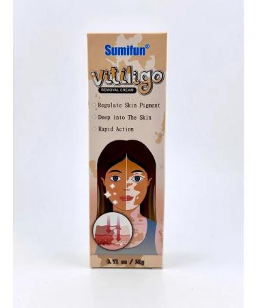 SUNVALLEY vitiligo treatment
