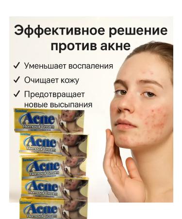 MAC1 Acne cream and acne for problem skin 5pcs