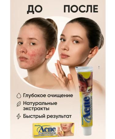MAC1 Acne cream and acne for problem skin 5pcs - Buy Online on GoSupps.com