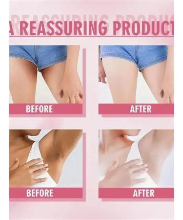 BESTQUALITY1 Whitening cream for an intimate zone and body in a set of 3pcs - Buy Online on GoSupps.com