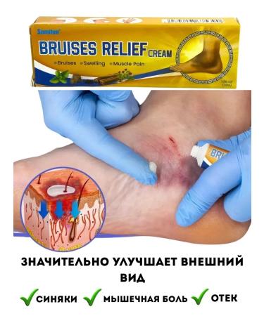 Zhodik2 Cream from bruises and bruises - Buy Online on GoSupps.com