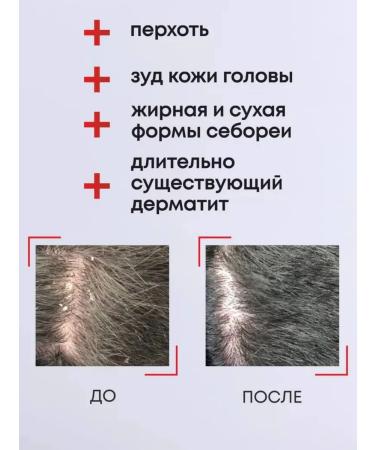 KERASTASE Kerastase Symbiose Bain Purete Anti-Pelliculaire Purifying Anti-Dandruff Shampoo-Bath - Buy Online on GoSupps.com