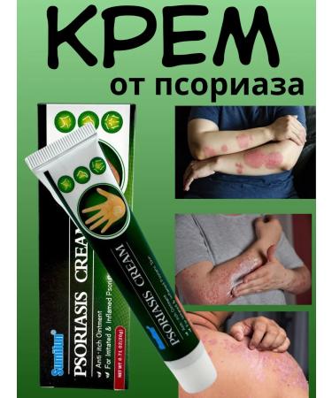 ERKE Chinese ointment from psoriasis of skin diseases therapeutic