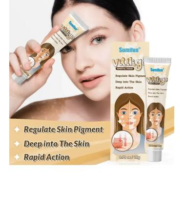 Spoty Brand Ointment from pigment spots from vitiligo cream - Buy Online on GoSupps.com