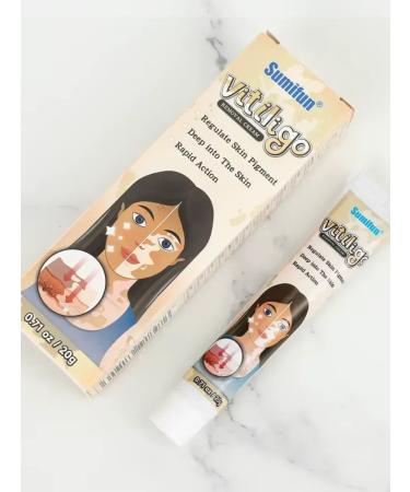 Spoty Brand Ointment from pigment spots from vitiligo cream - Buy Online on GoSupps.com