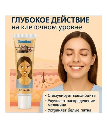 SLana2 Remedy for vitiligo cream from white spots on the face and body - Buy Online on GoSupps.com