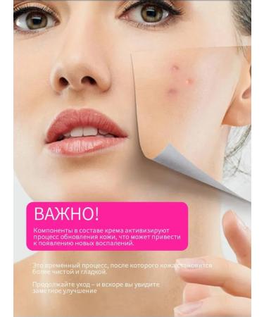 VOIS Face cream with salicylic acid from acne 50 ml - Buy Online on GoSupps.com