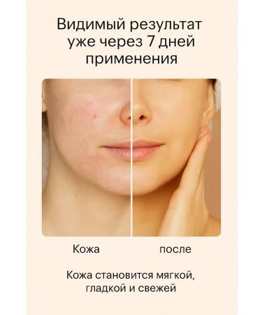 Adinar Moisturizing toner and emulsion 2 pcs - Buy Online on GoSupps.com