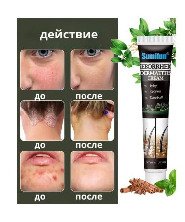 AZHAR Skin ointment from itching dermatitis Chinese set 3pcs - Buy Online on GoSupps.com