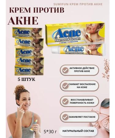 zoomba Acne cream 5 pieces