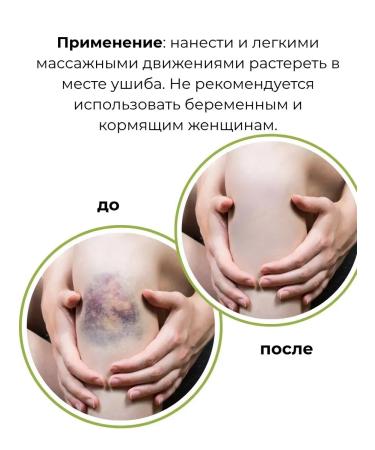 pol2 Cream ointment from bruises and bruises for joints and ligaments - Buy Online on GoSupps.com