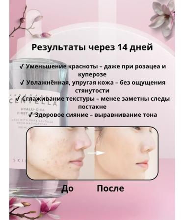 Aysara Hero for the face with centella and hyaluronic acid - Buy Online on GoSupps.com