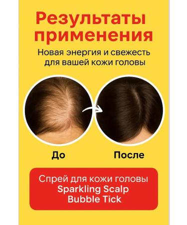 aikanya13 Scalp peeling - Buy Online on GoSupps.com