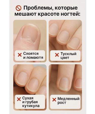 aikanya13 Lanbena gel for removing cuticle volume 20 g - Buy Online on GoSupps.com