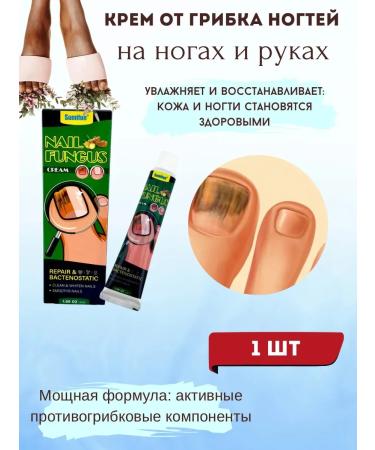 MILES 25 fungus cream on the legs and arms