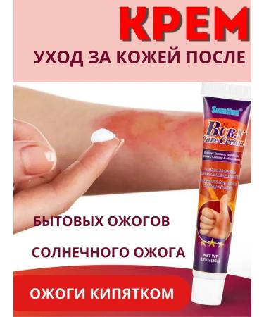 BIRKAZHY The cream after thermal burns relieves burning and pain