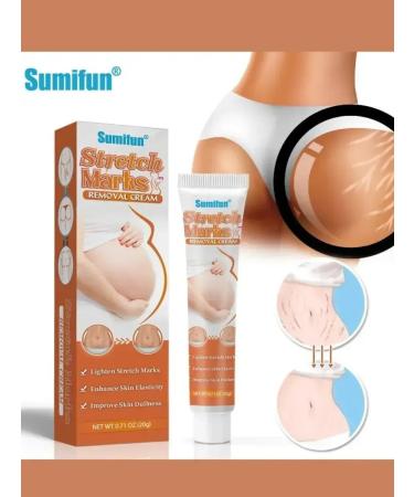 Welcome 1 Cream from stretch marks and cellulite for pregnant women and adolescents - Buy Online on GoSupps.com