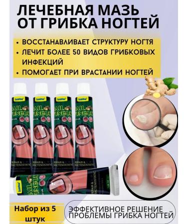 Canida Therapeutic ointment from nail fungus set of 5 pieces