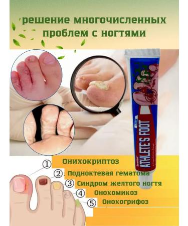 NUNA Ointment from nail fungus - Buy Online on GoSupps.com