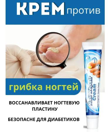 BIRKAZHY Cream against nail fungus treatment