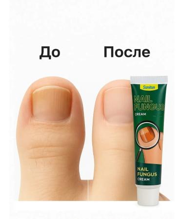 PatiMari Nail fungus cream 30g - Buy Online on GoSupps.com