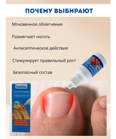 BIRKAZHY Remedy and care of ingrown nails - Buy Online on GoSupps.com