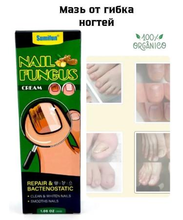 Victoria Ointment for nail fungus.