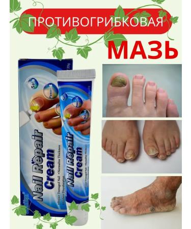KEVO Cream against the nail fungus smell of the legs from candida