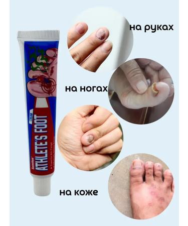 MadiMax Ointment from nail fungus and skin - Buy Online on GoSupps.com