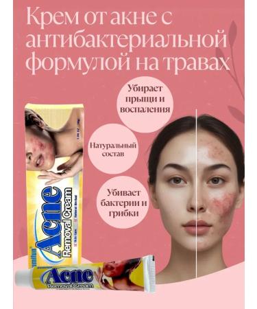 Canida Acne and acne cream