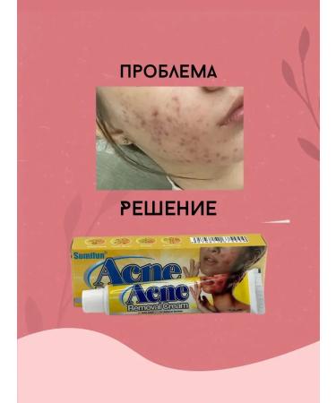 Canida Acne and acne cream - Buy Online on GoSupps.com