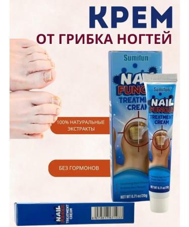 BIRKAZHY Fleep fungus cream for arms and legs