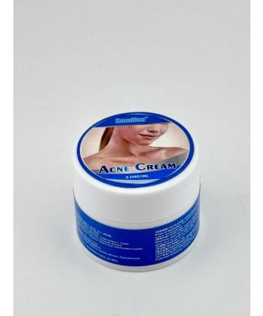 AYPOSH Acne and acne cream - Buy Online on GoSupps.com