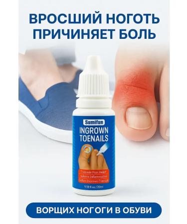Evelina Evka Antifungal drops for the treatment of ingrown nails