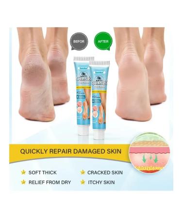 Spoty Brand Chinese ointment from cracks on heels - Buy Online on GoSupps.com