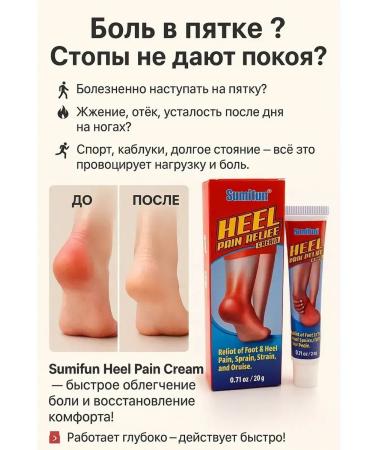 MMLIKA Pain in the heels of the heel spurs