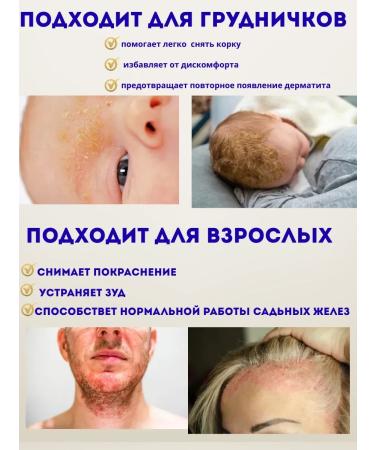 LIFOX dermatitis cream - Buy Online on GoSupps.com