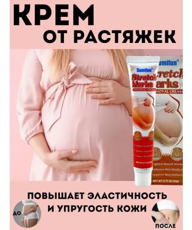 DASTAN1 Firming cream for stretch marks