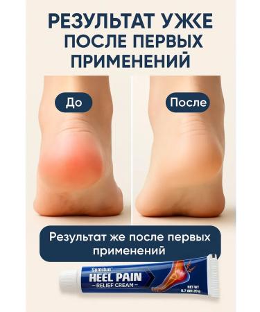 di92 Anesthetic cream for heels - Buy Online on GoSupps.com