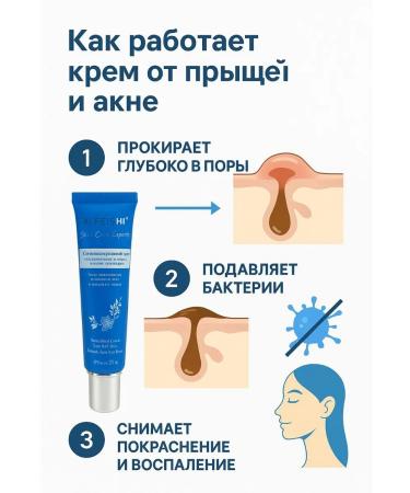 JA7 Acne cream and face acne against inflammation and post -acne - Buy Online on GoSupps.com