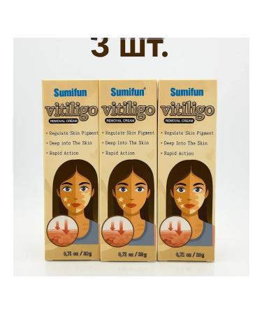 MK77 Vitiligo cream 3pcs ointment from freckles and white spots