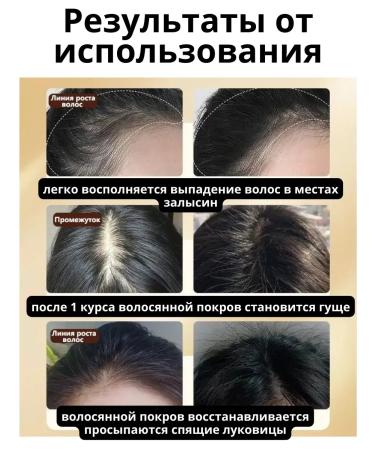 Bilioner Hair loss shampoo for growth - Buy Online on GoSupps.com