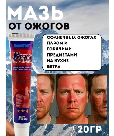 muva Ointment from burns from hot and cold