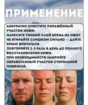 muva Ointment from burns from hot and cold - Buy Online on GoSupps.com